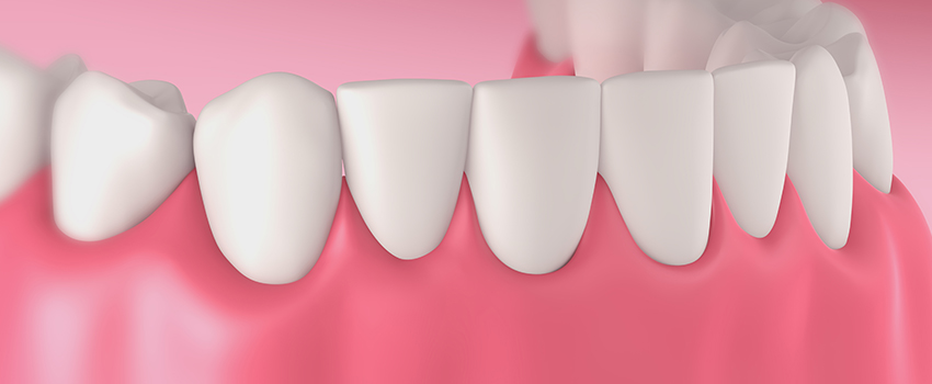 Özel MaviDent Ağız ve Diş Sağlığı Polikliniği Periodontoloji Tedavisi